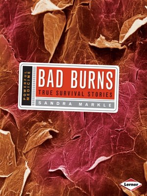 cover image of Bad Burns